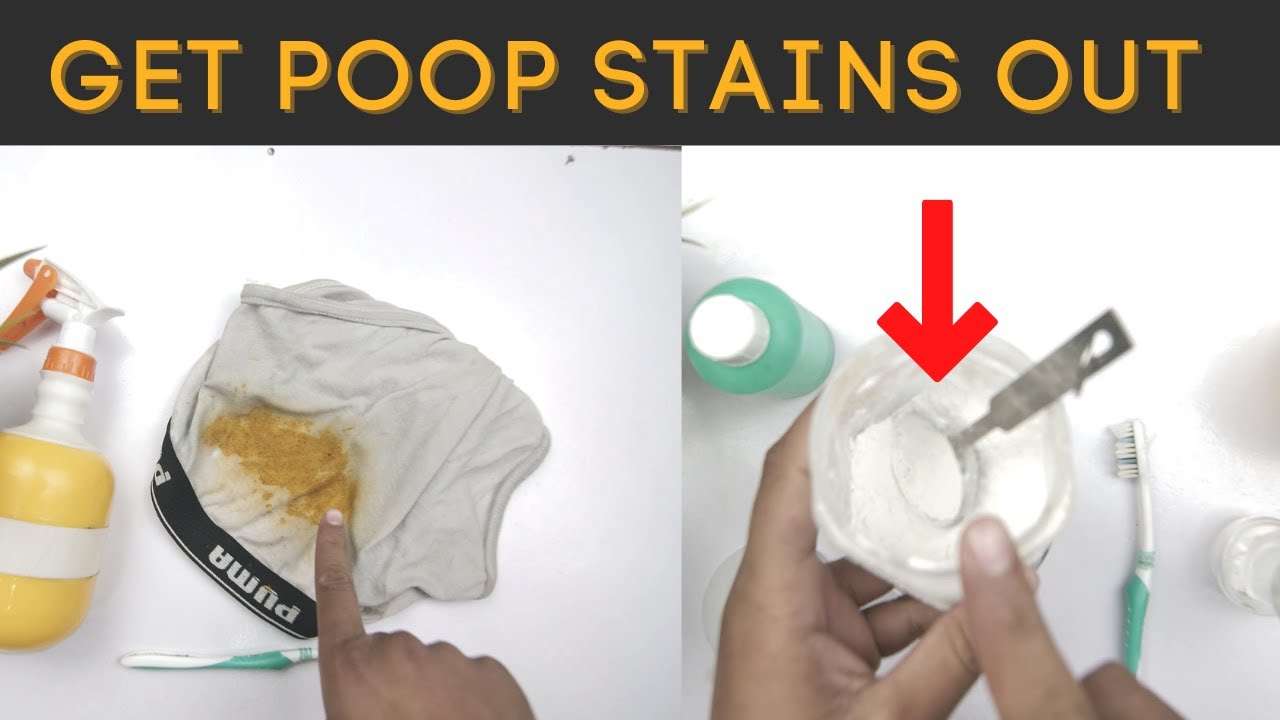 How to Get Poop Stains Out of Underwear